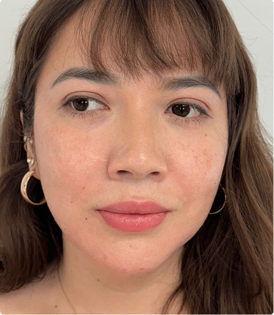 after@1.2x after@1.2x